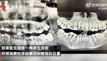 女子疑因拔错牙又被塞回坠楼身亡，多方回应