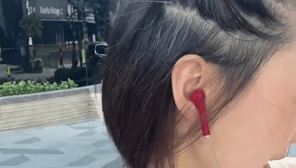 女演员打白发针2个月收效甚微，没人管管可疑的新疗法？