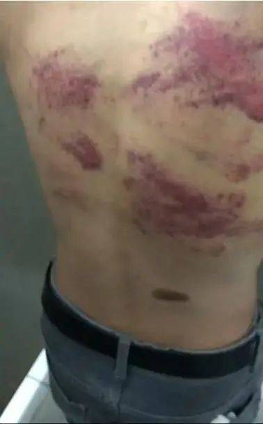广西21岁被骗缅甸小伙被解救！父亲：他已出园区，不知回国时间，其曾用支付宝发消息求救“被打得耳膜穿孔”